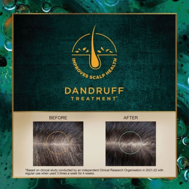 Indulekha Svetakutaja Oilayurvedic Medicinal Oil for Dandruff