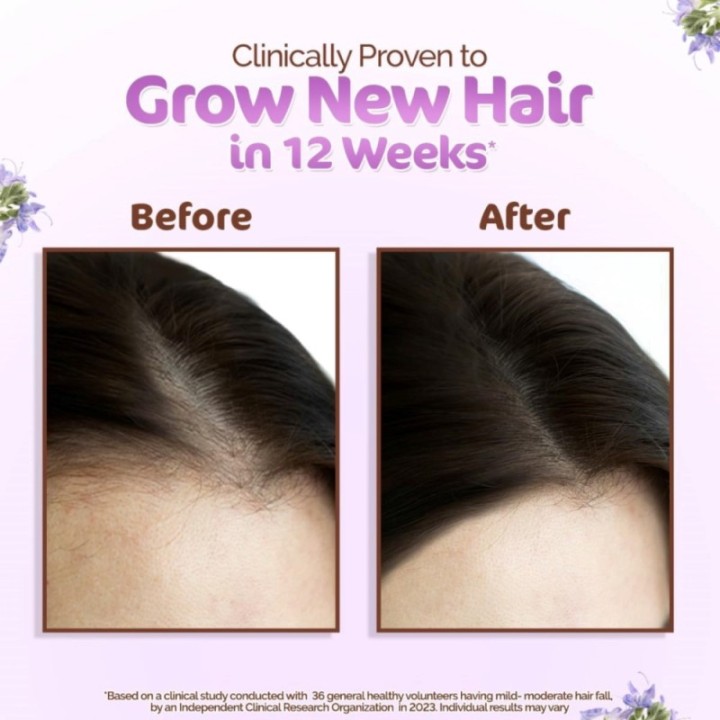 Mamaearth Rosemary Hair Growth Oil with Rosemary & Methi Dana