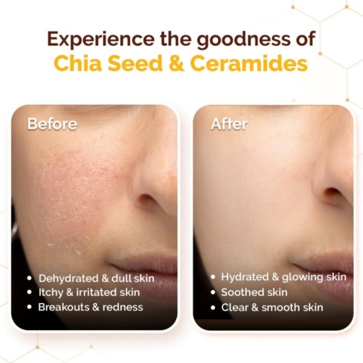 Mamaearth Chia Calming Sunscreen with Chia Seed & Ceramides